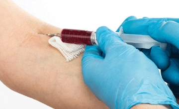 Hepatit B Nasıl Bulaşır